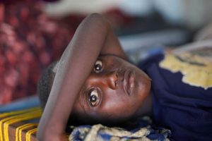تعبر الصورة بعمق عن الجانب الإنساني المأساوي لأزمة الكوليرا في السودان، إذ يظهر الطفل كرمز لمعاناة المدنيين، خاصة الأطفال، الذين يتحملون العبء الأكبر من تفشي الأوبئة وانهيار الخدمات الصحية. الألوان الباهتة والظلال الخافتة في الصورة تعزز الإحساس بالعجز والإنهاك في بيئة تعاني من الفقر والنزوح.