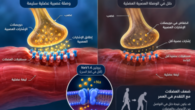ضعف العضلات مع التقدم في العمر بسبب خلل التواصل بين الأعصاب والعضلات